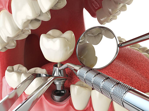 Best Mobile Emergency Dentist in Paloma Creek, TX